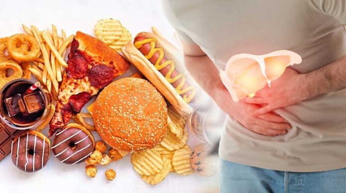 Health tips | వీటిని తింటున్నారా.. మీ లీవర్ డ్యామేజ్ ఖాయం..