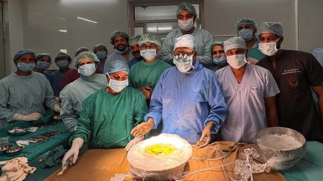 Osmania Hospital | దేశంలోనే తొలిసారి పేగు మార్పిడి ఆపరేషన్​.. ఎక్కడో తెలుసా..!