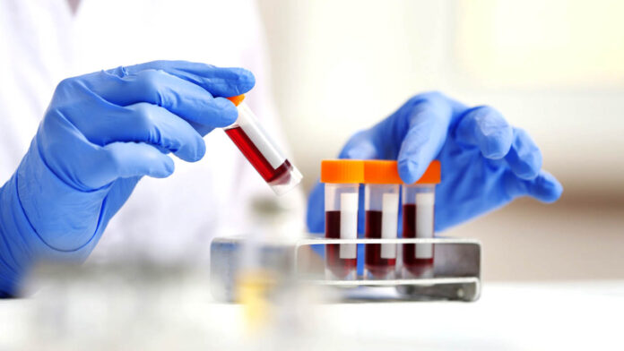 Blood Test