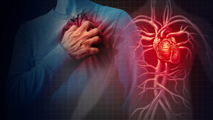 Cardiac Attack