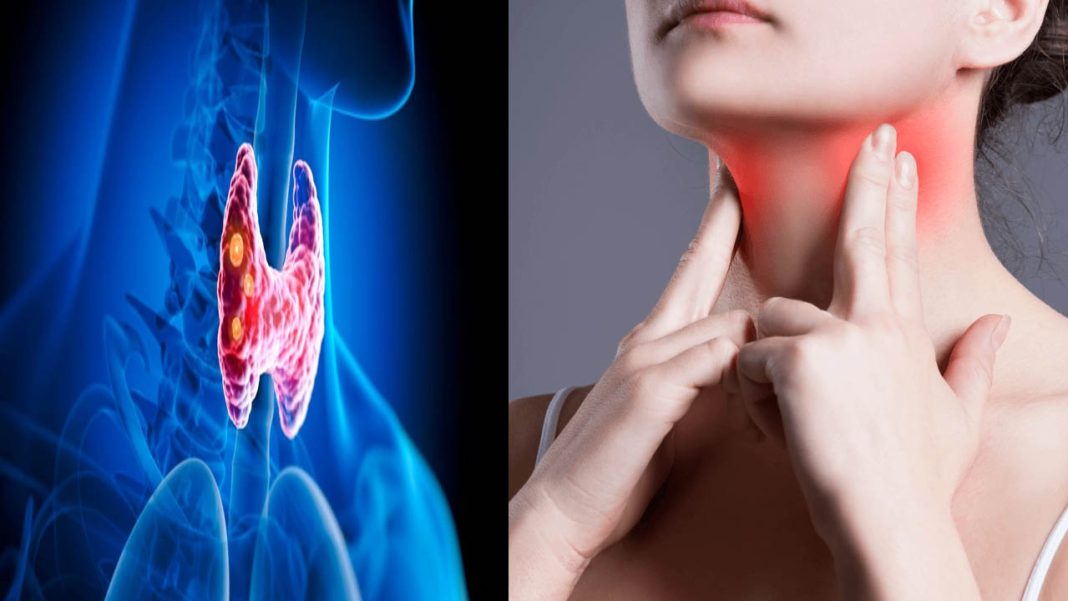 Thyroid | ఈ సంకేతాలు ఉన్నాయా.. అయితే థైరాయిడ్ చెక్​ చేయించుకోవాల్సిందే..!
