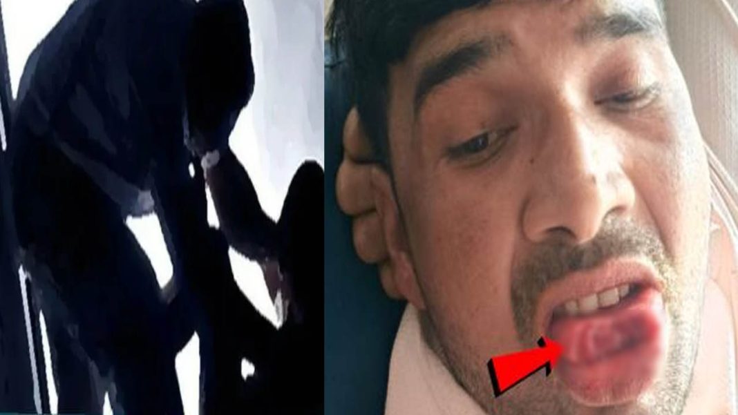 Woman Bites Man Tongue | లైంగిక దాడికి ప్రయత్నం.. కీచకుడి నాలుకను కొరికేసిన సివంగి!