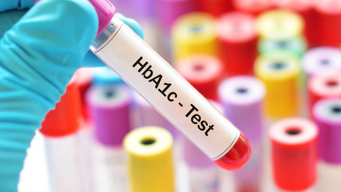 HbA1c Test | హెచ్‌బీఎ1సీ టెస్ట్​.. మధుమేహ బాధితులకు ఎంత ముఖ్యమంటే..!